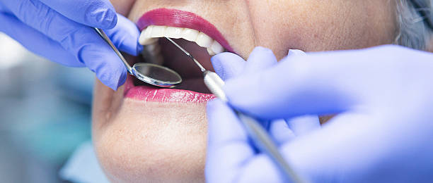Best Dentist for Tooth Abscess  in Perry, UT